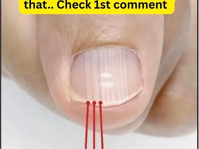 If you have these lines on your nails after 40, it is a clear sign that..