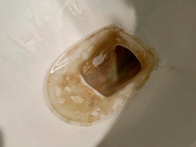 The Morning I Found a Snake in My Toilet — and Learned Just How Wild Home Life Can Be