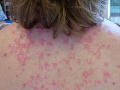 Here are the consequences of sleeping with…